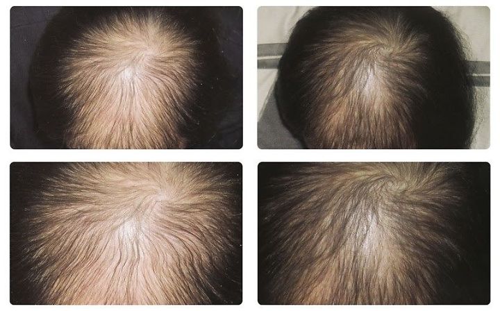 tinh dau buoi nguyen chat tphcm