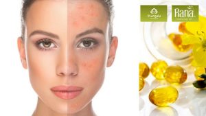 Tinh Dầu Gừng Gió có hoạt tính chống oxy hóa cao, dùng để chống lão hóa, hứa hẹn chống nếp nhăn hiệu quả.